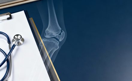 Ribercon - Auxílio-Acidente: decifrando a “necessidade de despender maior esforço” na incapacidade laboral parcial permanente